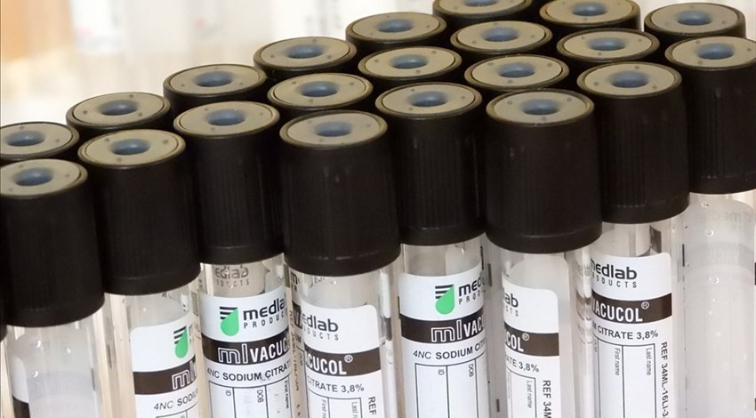 Prelievi. Il 9 maggio le risposte alle domande di Mugello in Comune e Dicomano che Verrà